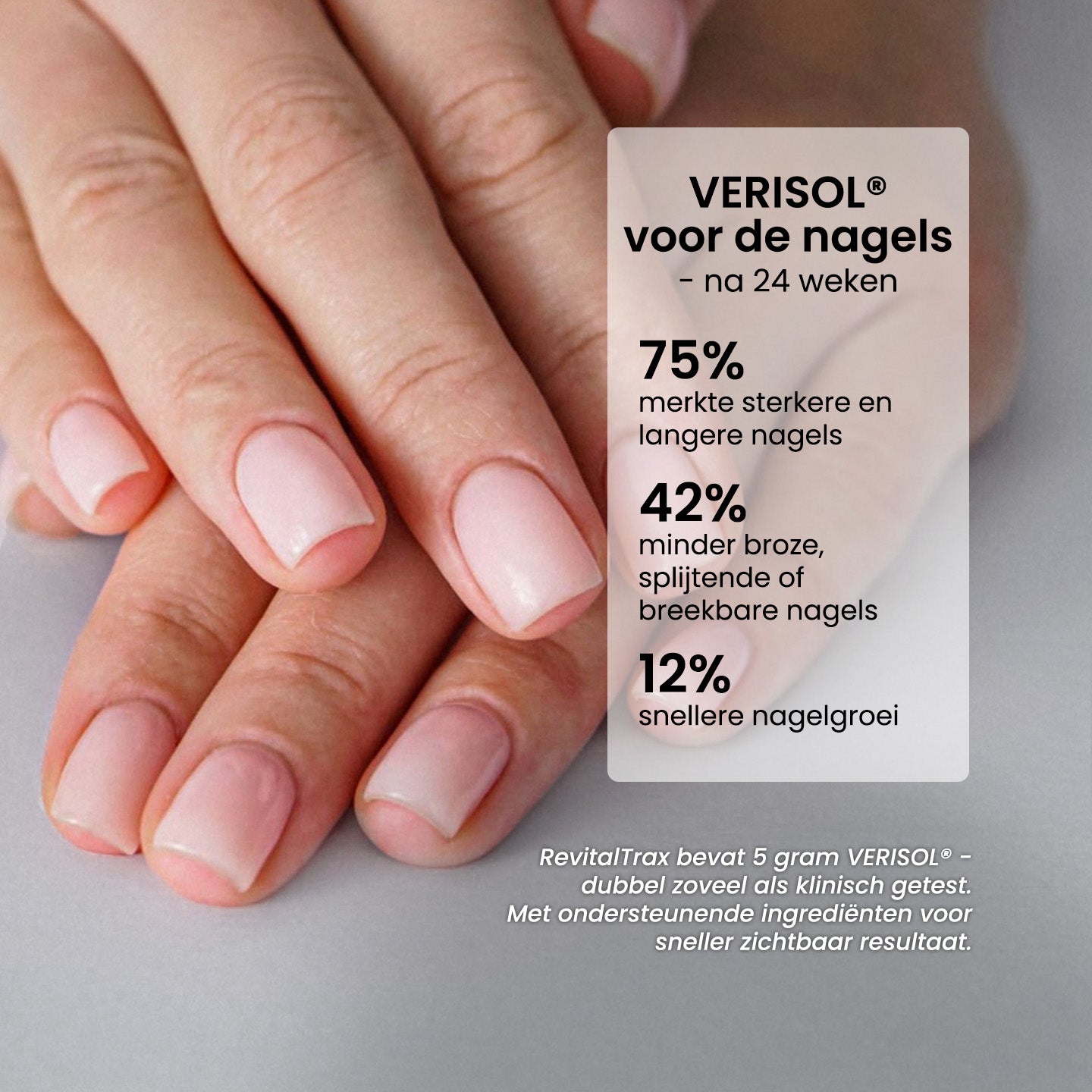 collagen-complex_clinical-results-nails_NL.jpg__PID:18216e64-3c5a-4e09-acec-75f8850da9e7